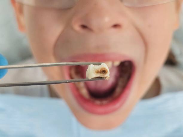 Best Emergency Dental Services for Seniors in Atwood, TN